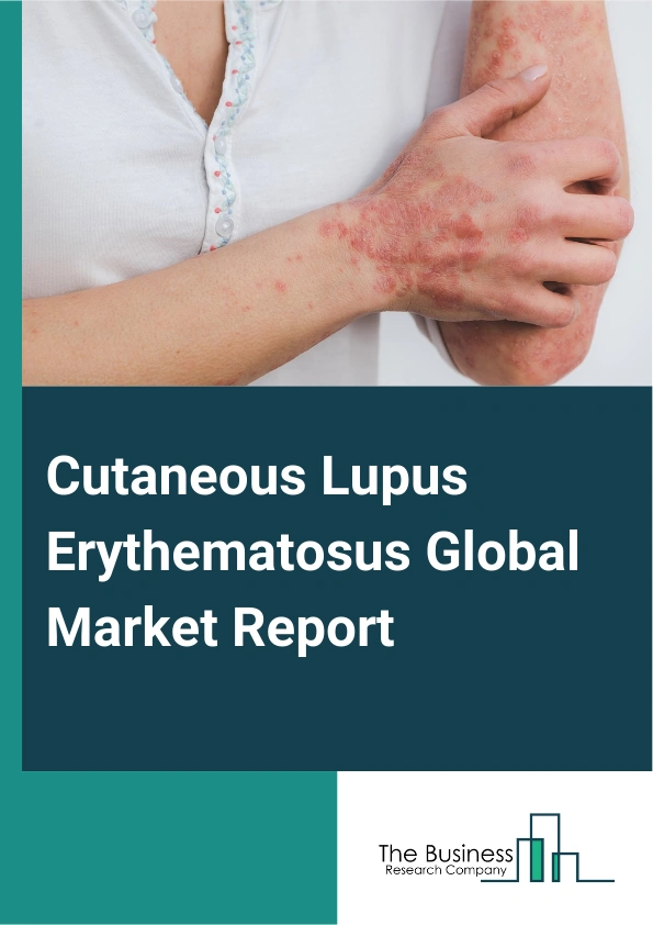 Cutaneous Lupus Erythematosus Global Market Report 2025 – By Type (Acute, Subacute, Intermittent, Chronic), By Drug Class (Retinoids, Corticosteroids, Immunosuppressants, Antimalarial Drugs, Other Drug Classes), By Route...