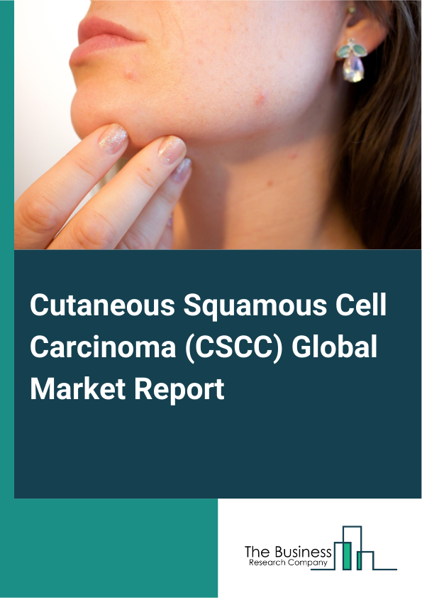 Global Cutaneous Squamous Cell Carcinoma (CSCC) Market Report 2025