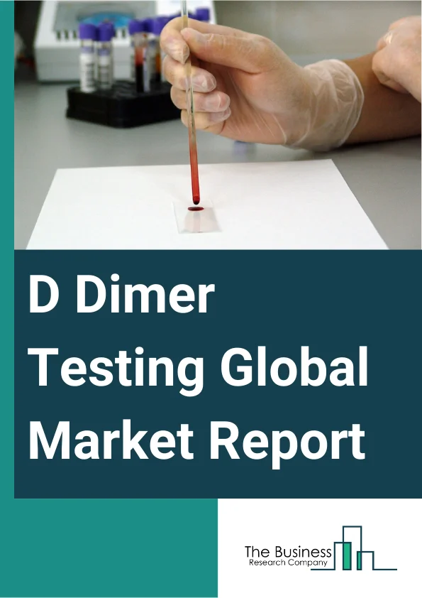 Global D Dimer Testing Market Report 2025