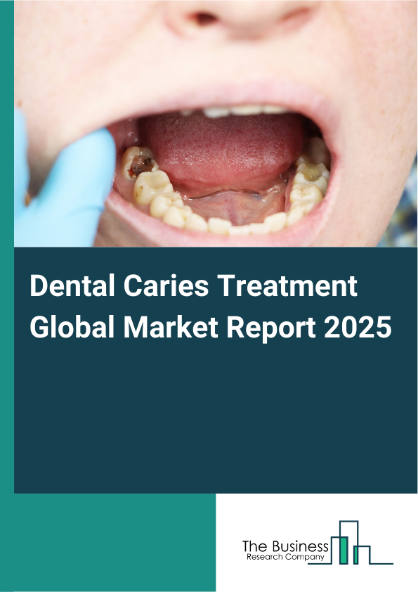 Global Dental Caries Treatment Market Report 2025