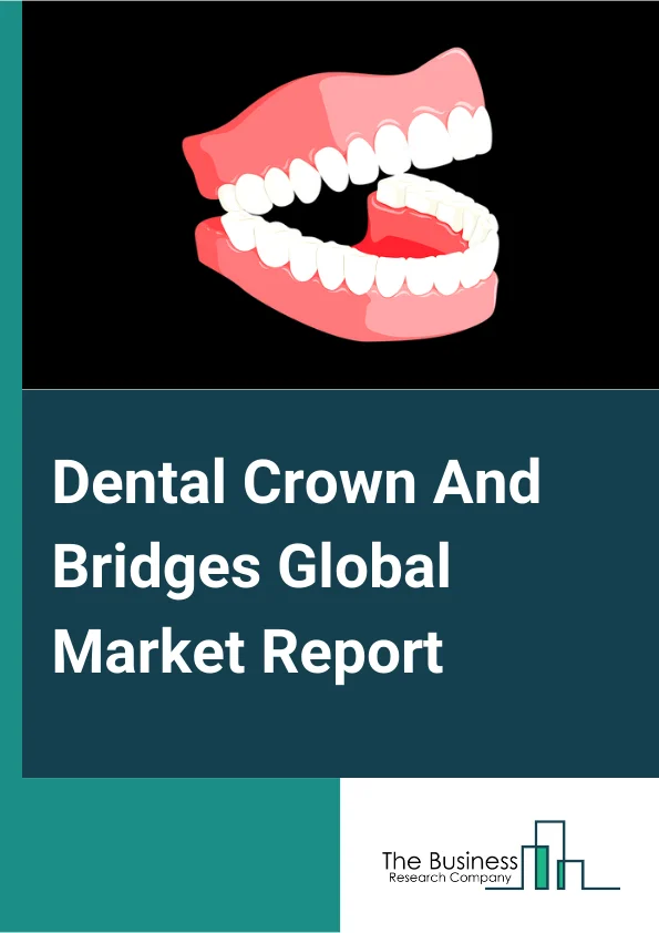 Dental Crown And Bridges Global Market Report 2024 – By Type (Crowns, Bridges), By Material (Ceramics, Porcelain Fused To Metals, Metals), By Price (Premium, Value, Discounted), By End User (Dental Hospitals And Clinics, Dental Laboratories, Other End Users) – Market Size, Trends, And Global Forecast 2024-2033