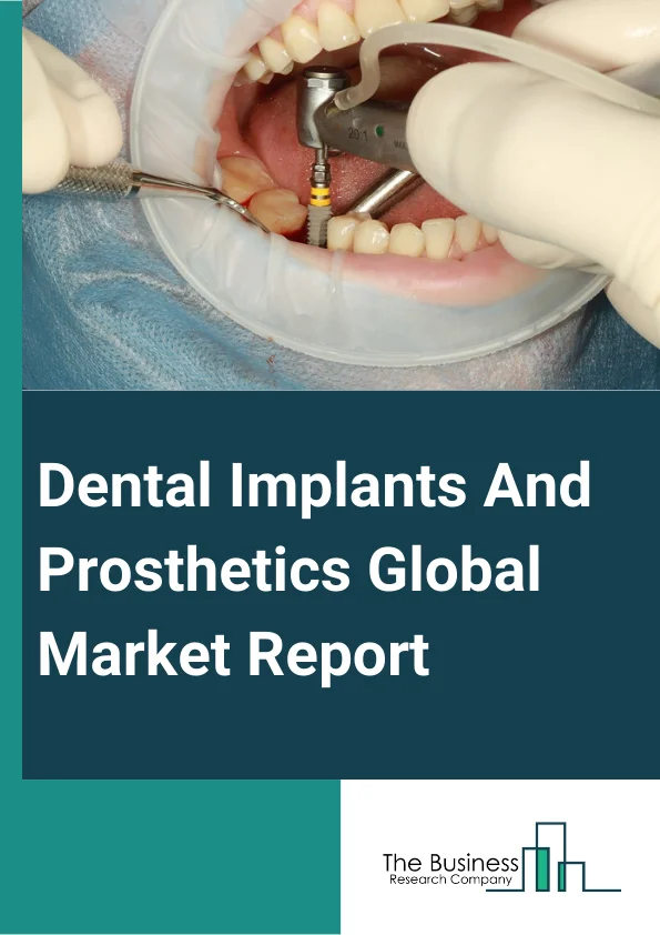 Dental Implants And Prosthetics Global Market Report 2024 – By Product Type (Dental Bridges, Dental Implants, Dental Crown, Abutment, Dentures, Inlays and Onlays, Other Products), By Design (Tapered Dental Implants, Parallel-Walled Dental Implants), By Material (Titanium, Zirconium, Metal, Ceramic, Other Materials), By Price (Premium Implants, Value Implants, Discounted Implants), By End-User (Dental Hospital And Clinics, Dental Laboratories, Other End-Users) – Market Size, Trends, And Global Forecast 2024-2033