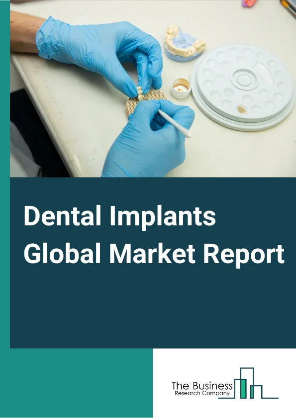 Dental Implants Global Market Report 2023 – By Product (Tapered Implants, Parallel Walled Implants), By Material (Titanium, Zirconium), By End-use (Hospitals, Dental Clinics) – Market Size, Trends, And Market Forecast 2023-2032