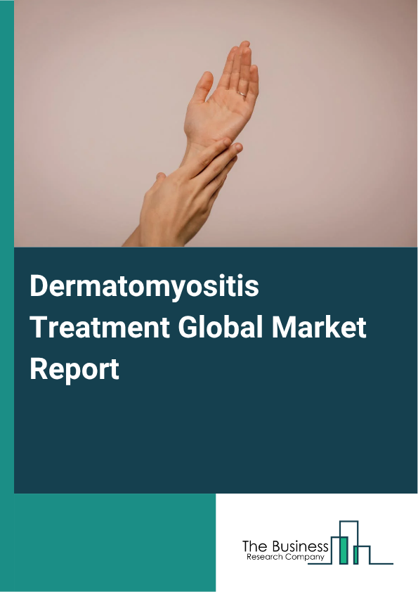 Global Dermatomyositis Treatment Market Report 2025