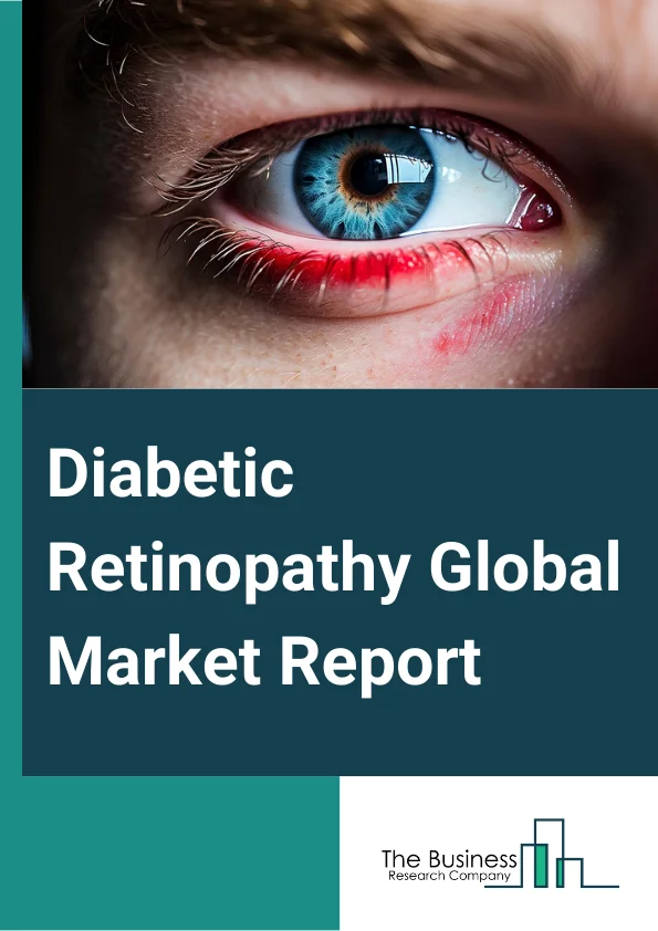 Diabetic Retinopathy Global Market Report 2024 – By Type (Proliferative Diabetic Retinopathy, Non-Proliferative Diabetic Retinopathy), By Treatment (Anti-VEGF Drugs, Intraocular Steroid Injection, Laser Photocoagulation, Vitreoretinal Surgery), By End-User (Hospitals, Ambulatory Surgical Centers, Other End Users) – Market Size, Trends, And Global Forecast 2024-2033