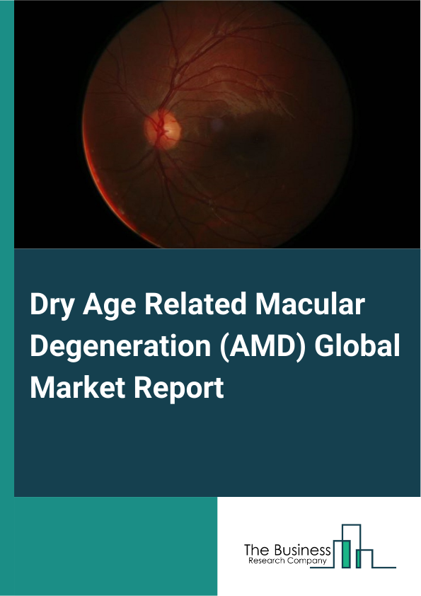 Global Dry Age Related Macular Degeneration (AMD) Market Report 2025