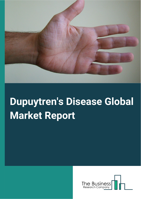 Global Dupuytren's Disease Market Report 2025