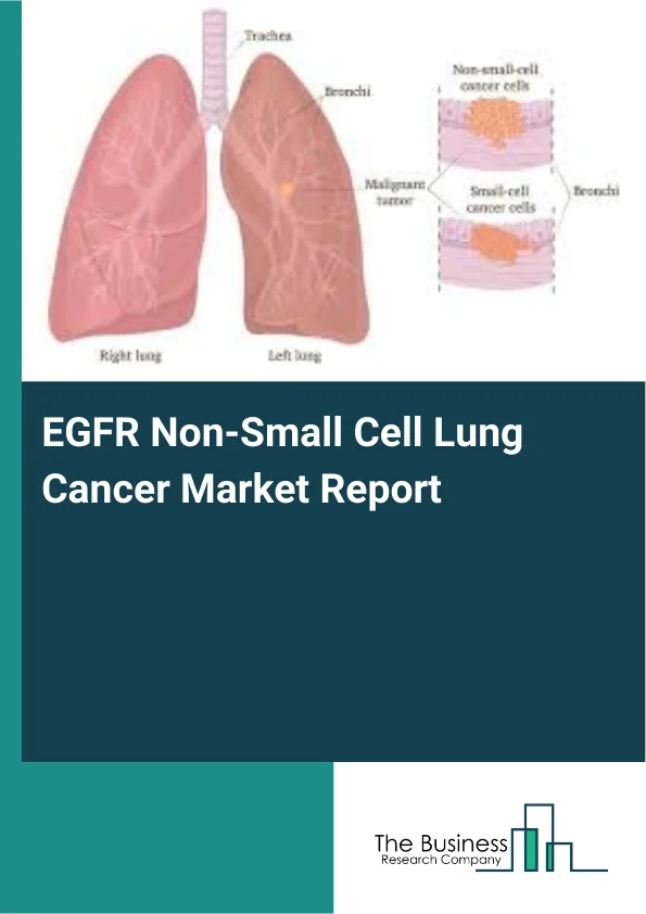 EGFR Non-Small Cell Lung Cancer Market Report Infographic Image
