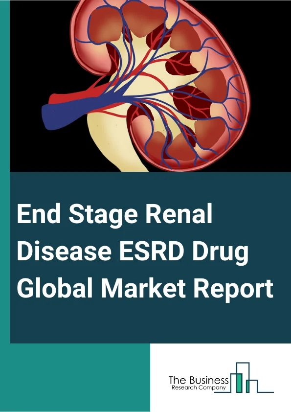 End Stage Renal Disease (ESRD) Drug Global Market Report 2024 – By Product Type (Calcimimetics, Vitamin D, Sterols, Potassium Binders, Calcium-Based Phosphate Binders, Other Products), By Indication (End Stage Renal Disease (ESRD) Induced Hyperparathyroidism, End Stage Renal Disease (ESRD) Induced Hyperphosphatemia, End Stage Renal Disease (ESRD) Induced Hyperkaliemia), By Distribution Channel (Hospital Pharmacy, Online Pharmacy, Retail Pharmacy), By End User (Hospitals, Homecare, Specialty Clinics, Other End Users) – Market Size, Trends, And Global Forecast 2024-2033