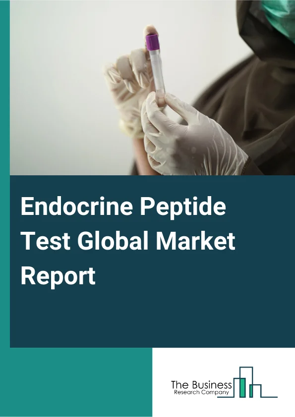 Global Endocrine Peptide Test Market Report 2025