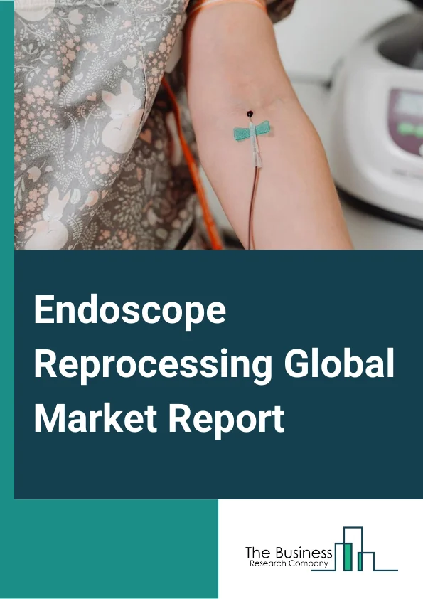 Endoscope Reprocessing Global Market Report 2024 – By Type (Flexible, Rigid), By Product (High-Level Disinfectants and Test Strips, Other Products), By End-User (Hospitals, Ambulatory Surgical Centers and Clinics, Other End-Users) – Market Size, Trends, And Global Forecast 2024-2033