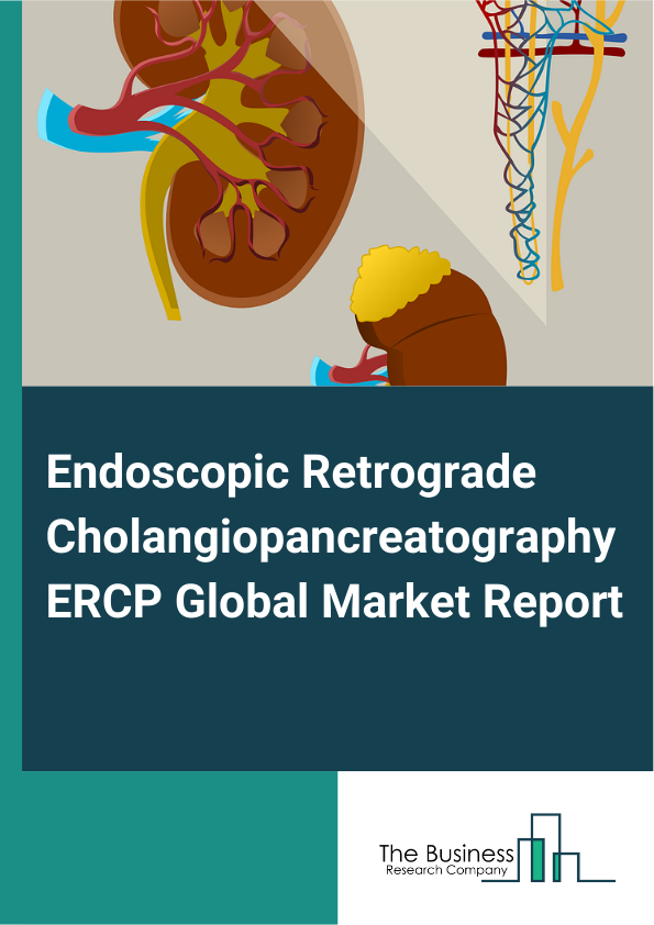 Global Endoscopic Retrograde Cholangiopancreatography ERCP Market Report 2025