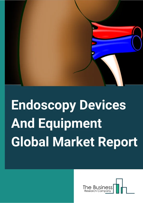 Endoscopy Devices And Equipment Global Market Report 2023 – By Product (Endoscope, Endoscopy Operative Devices, Endoscopy Visualization Systems), By Application (Bronchoscopy, Arthroscopy, Laparoscopy, Urology endoscopy, Neuroendoscopy, Gastrointestinal endoscopy, Obstetrics/gynecology endoscopy, ENT endoscopy, Other Applications), By End-User (Hospitals, Clinics, Other End Users) – Market Size, Trends, And Global Forecast 2023-2032