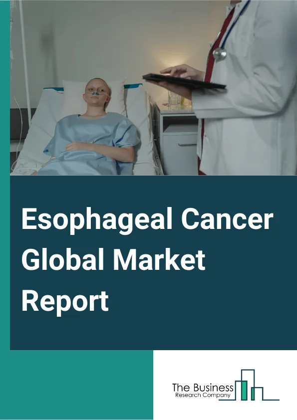 Esophageal Cancer Global Market Report 2024 – By Type (Esophageal Squamous-Cell Carcinoma, Esophageal Adenocarcinoma, Other Types), By Treatment Type (Chemotherapy, Targeted Therapy, Other Treatment Types), By Route Of Administration (Oral, Parenteral, Other Routes Of Administration), By Distribution Channel (Hospital Pharmacy, Online Pharmacy, Retail Pharmacy), By End Users (Hospitals, Homecare, Specialty Centers, Other End Users) – Market Size, Trends, And Global Forecast 2024-2033