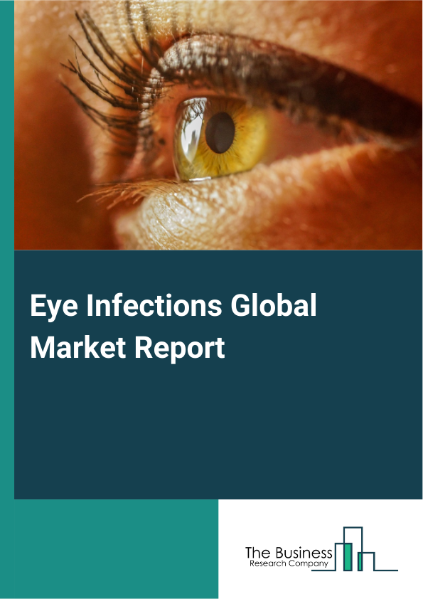 Global Eye Infections Market Report 2025