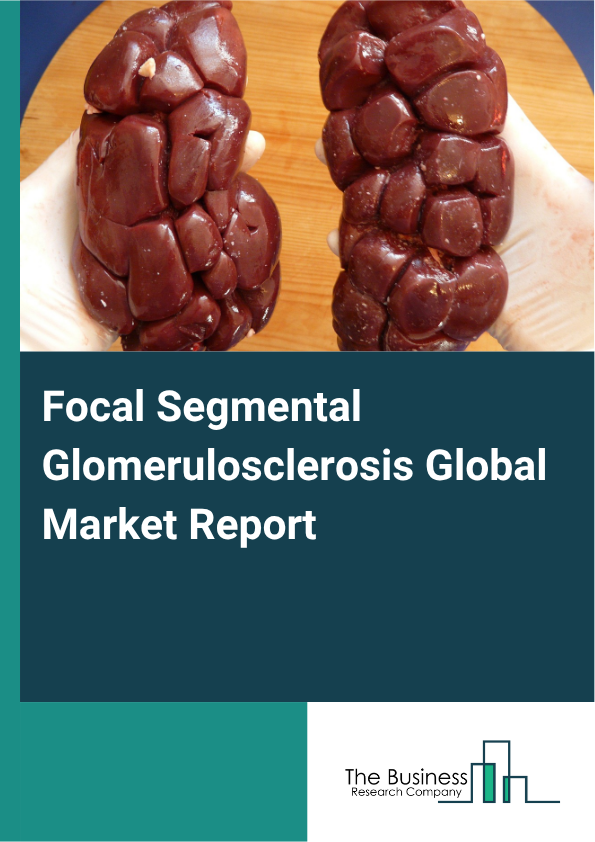 Global Focal Segmental Glomerulosclerosis Market Report 2025