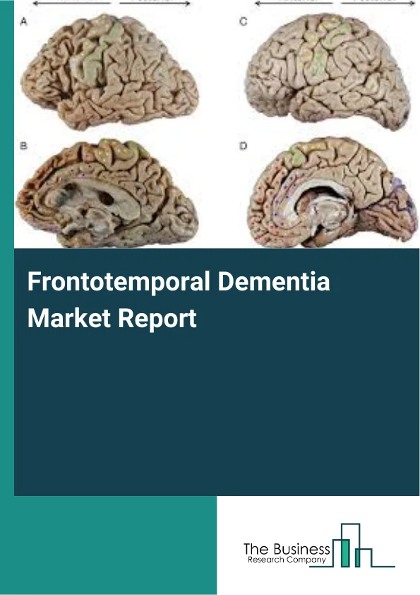 Frontotemporal Dementia Market Report Infographic Image
