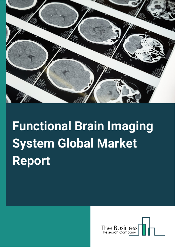 Global Functional Brain Imaging System Market Report 2025