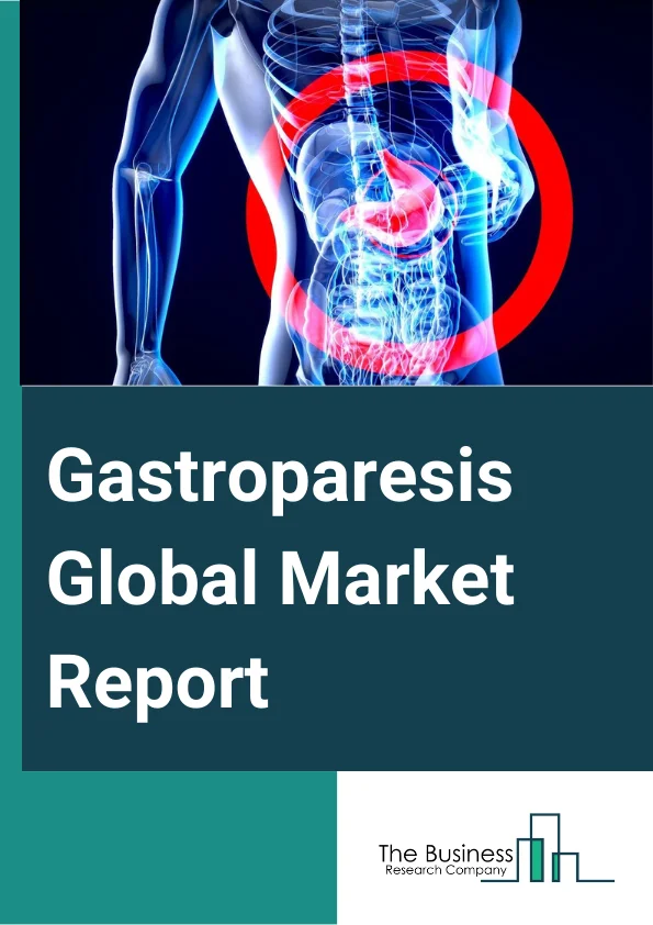 Gastroparesis Global Market Report 2024 – By Treatment Modality (Medications, Dietary Modifications, Medical Devices, Other Therapies), By Gastroparesis Type (Idiopathic, Diabetic, Post- Surgical, Other Types), By Patient Demographics (Pediatric Gastroparesis, Adult Gastroparesis), By Distribution Channel (Retail Pharmacies, Hospital Pharmacies, Other Distribution Channels), By End User (Hospitals And Clinics, Ambulatory Surgical Centers, Home Care Settings) – Market Size, Trends, And Global Forecast 2024-2033