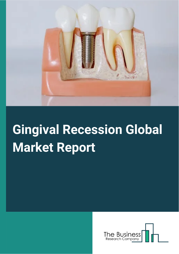 Global Gingival Recession Market Report 2025