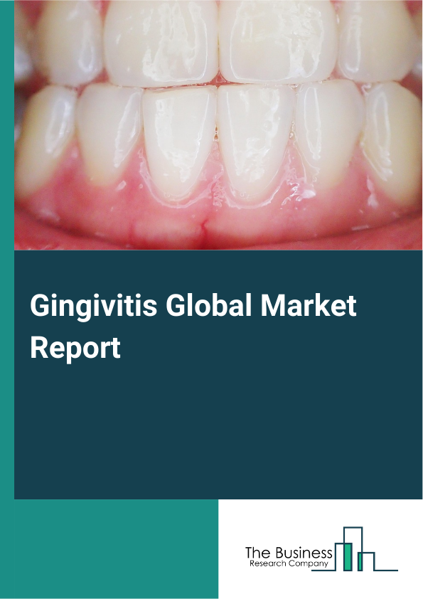 Global Gingivitis Market Report 2025