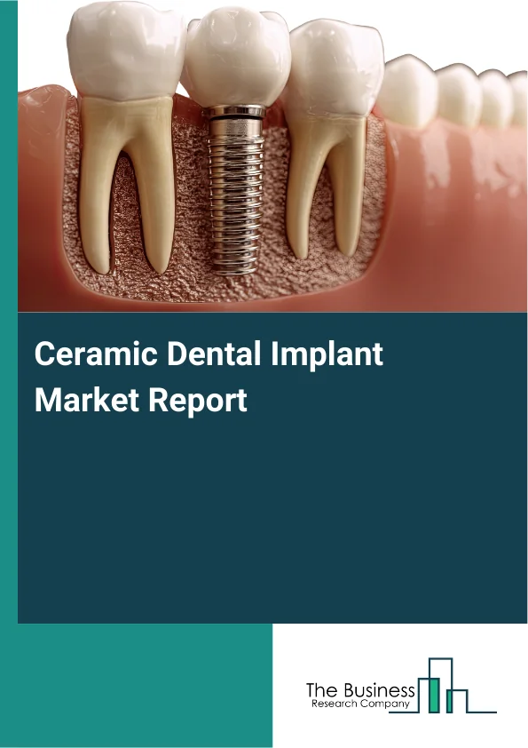 Ceramic Dental Implant Market Global Report 2026 Market Report Infographic Image