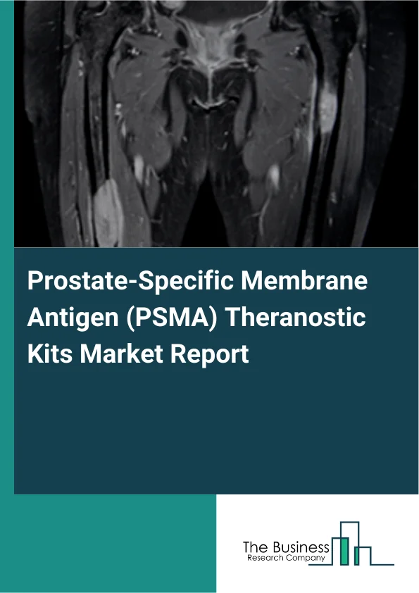 Prostate-Specific Membrane Antigen (PSMA) Theranostic Kits Market Global Report 2026 Market Report Infographic Image