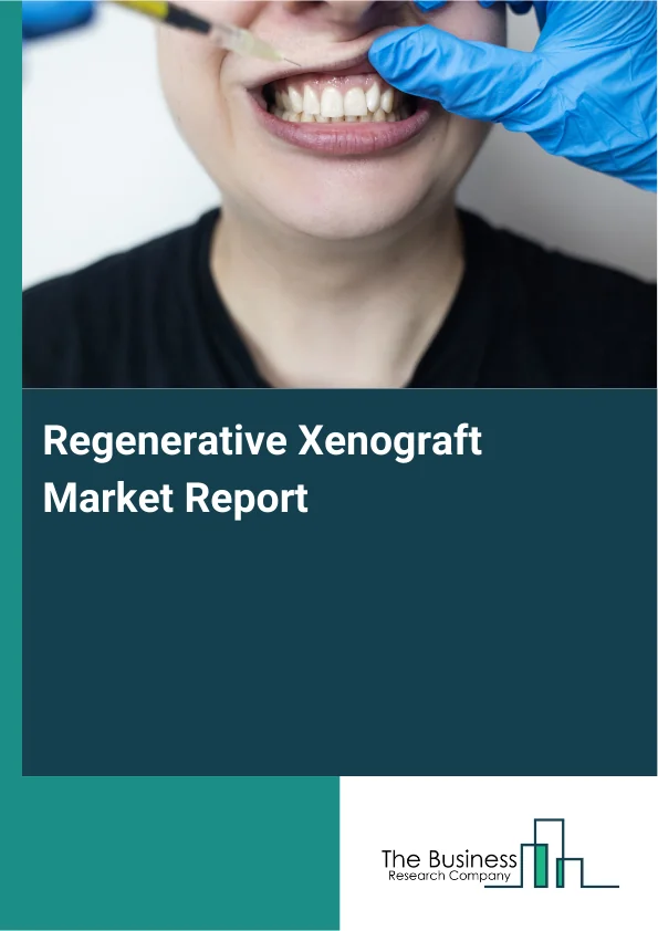 Regenerative Xenograft Market Global Report 2026 Market Report Infographic Image