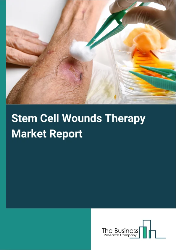 Stem Cell Wounds Therapy Market Global Report 2026 Market Report Infographic Image