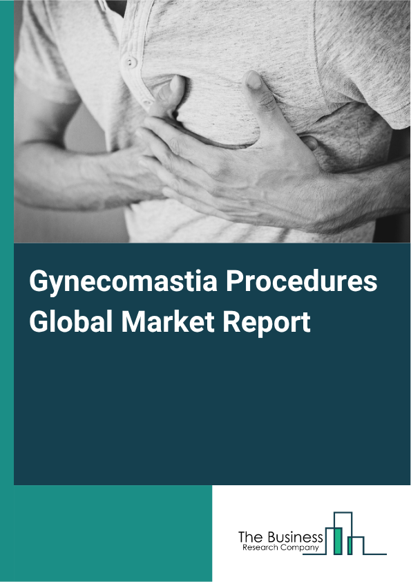 Gynecomastia Procedures Global Market Report 2025 - By Procedure Type (Liposuction, Mastectomy, Thyroid Hormone Therapy, Medications, Ultrasound), By Age Group (Adolescents, Adults, Elderly), By End-User (Hospitals, Cosm...