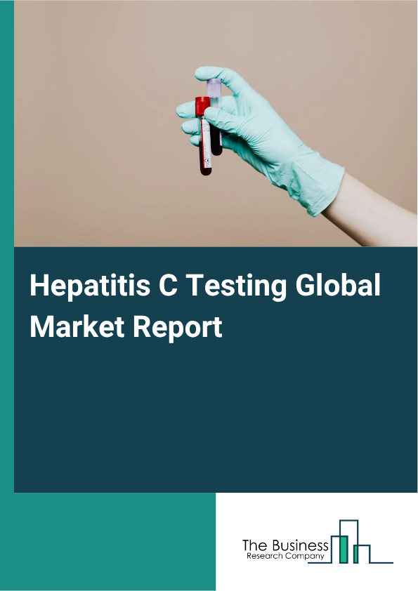 Global Hepatitis C Testing Market Report 2025