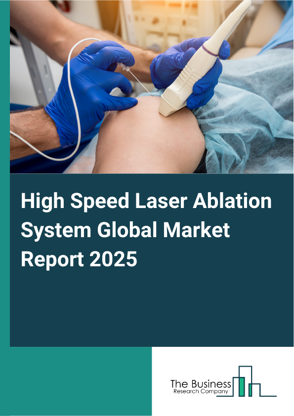 Global High Speed Laser Ablation System Market Report 2025