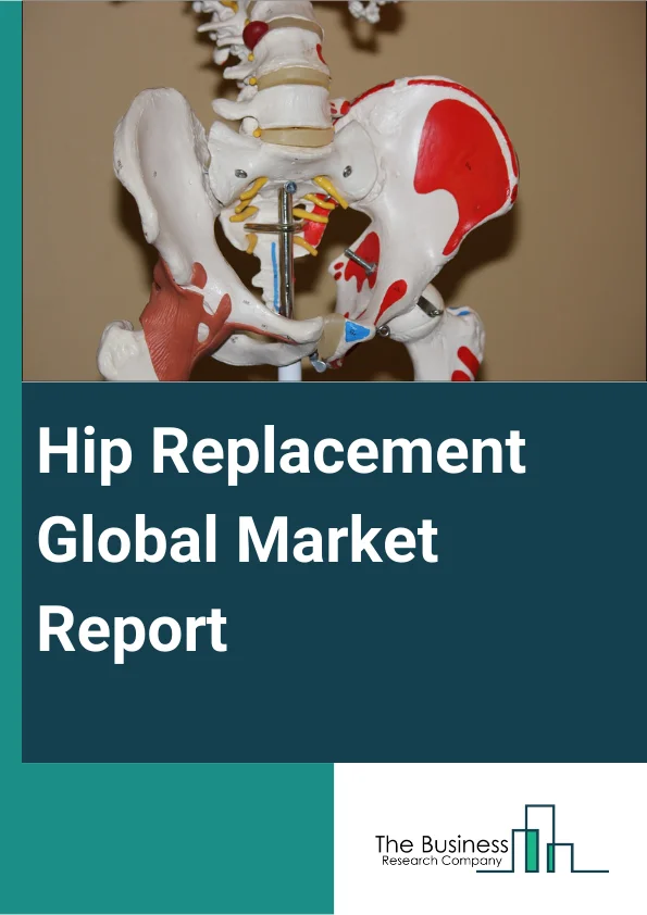 Hip Replacement Global Market Report 2023