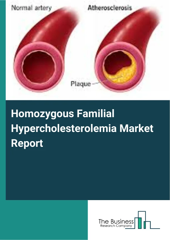 Homozygous Familial Hypercholesterolemia Market Report Infographic Image