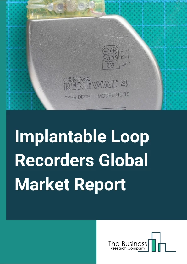 Implantable Loop Recorders Global Market Report 2025 – By Product (Manual, Automatic), By Application (Atrial fibrillation, Cardiac Arrhythmia, Cardiac Syncope), By End Users (Hospitals, Cardiac Centers and Clinics, Ambulatory Surgical Centers) – Market Size, Trends, And Global Forecast 2025-2034