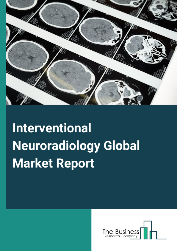 Global Interventional Neuroradiology Market Report 2025