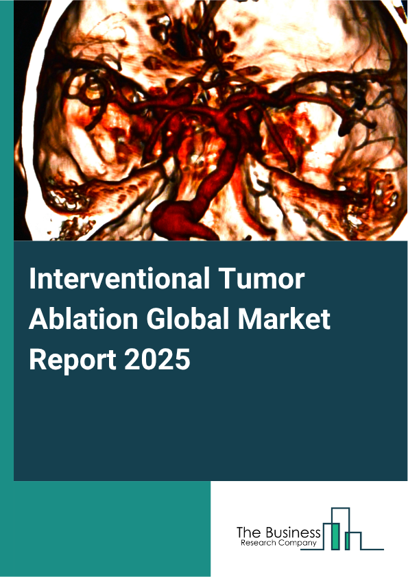 Global Interventional Tumor Ablation Market Report 2025 