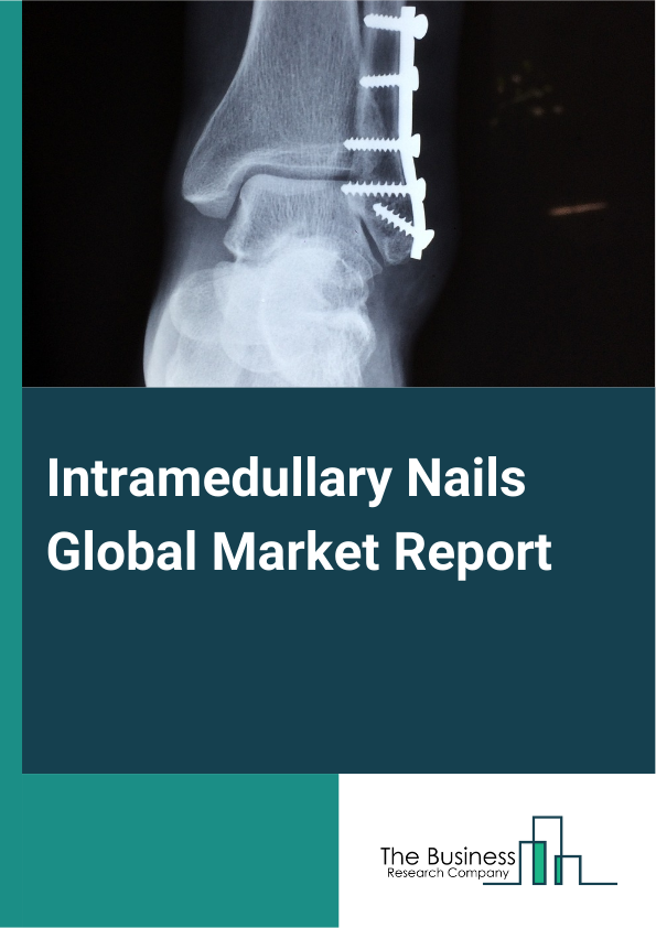 Global Intramedullary Nails Market Report 2025