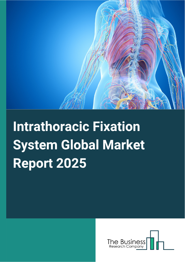 Global Intrathoracic Fixation System Market Report 2025