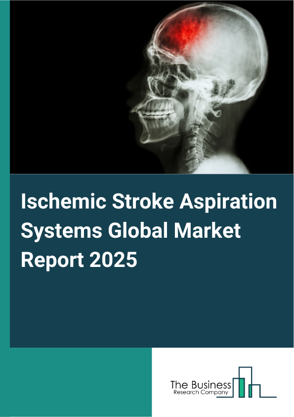 Global Ischemic Stroke Aspiration Systems Market Report 2025