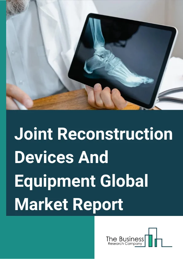 Joint Reconstruction Devices And Equipment Global Market Report 2025 – By Product Type (Knee Reconstruction Devices, Hip Reconstruction Devices, Extremity Reconstruction Devices), By Application (Arthrodesis, Arthroscopy, Joint Replacement Surgery, Osteotomy, Resurfacing Surgery, Small Joint Surgery), By End User (Hospitals, Orthopedic Clinics, Ambulatory Surgical Centers) – Market Size, Trends, And Global Forecast 2025-2034