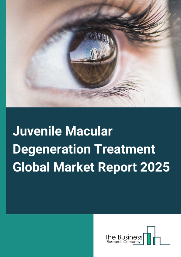Global Juvenile Macular Degeneration Treatment Market Report 2025