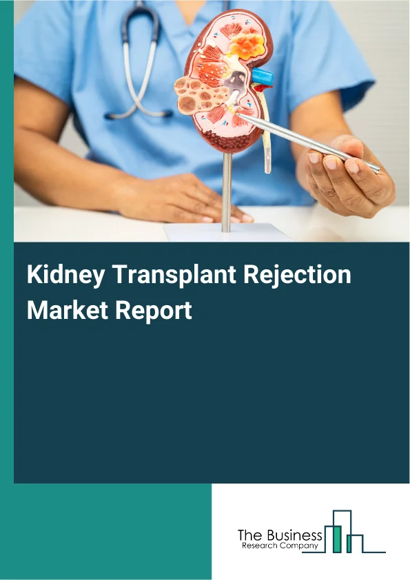 Kidney Transplant Rejection Market Report Infographic Image
