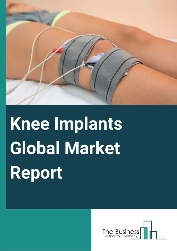Knee Implants Global Market Report 2024 – By Product (Total Knee Replacement, Partial Knee Replacement, Revision Knee Replacement), By Component Type (Fixed-Bearing Implants, Mobile-Bearing Implants), By Material (Stainless Steel, Cobalt-Chromium Alloys, Titanium Alloys, Polyethylene, Ceramics, Other Materials), By Fixation Type (Cemented, Cementless, Hybrid), By End User (Hospitals And Orthopedic Clinics, Ambulatory Surgical Centers, Other End Users) – Market Size, Trends, And Global Forecast 2024-2033
