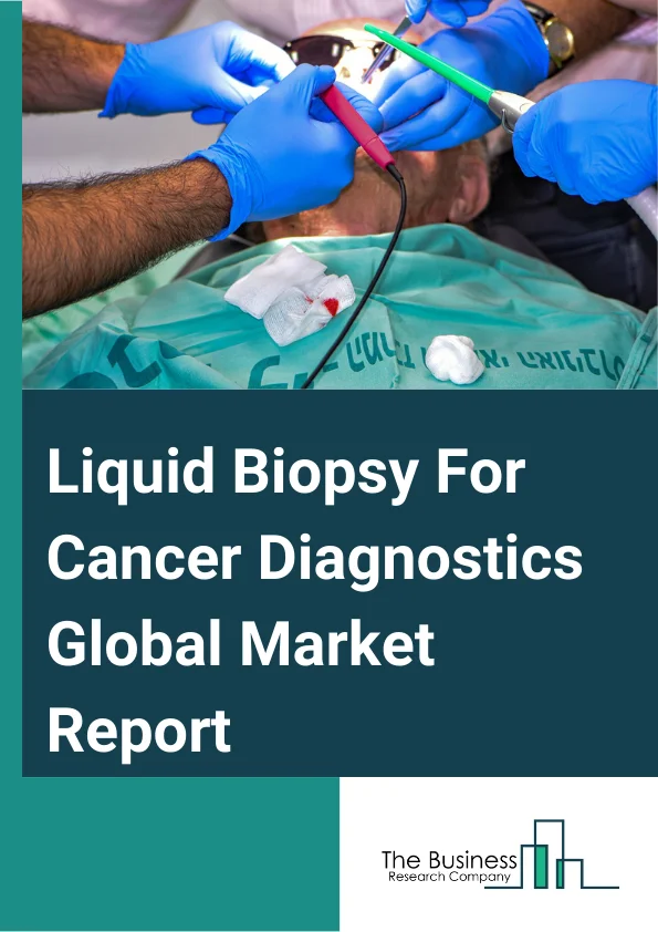 Liquid Biopsy For Cancer Diagnostics Global Market Report 2024 – By Type (Product, Services), By Sample (Blood, Urine, Saliva), By Cancer (Lung Cancer, Breast Cancer, Colon Cancer, Other Cancers), By End-User (Hospitals, Diagnostic Centers, Other End-Users) – Market Size, Trends, And Global Forecast 2024-2033