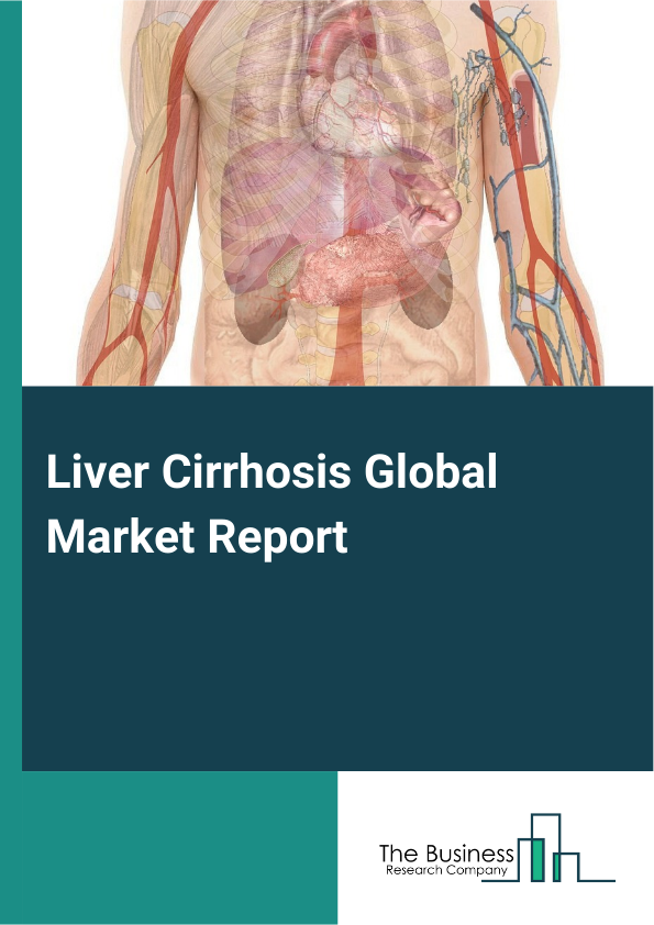Global Liver Cirrhosis Market Report 2025 