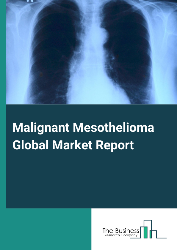 Global Malignant Mesothelioma Market Report 2025 