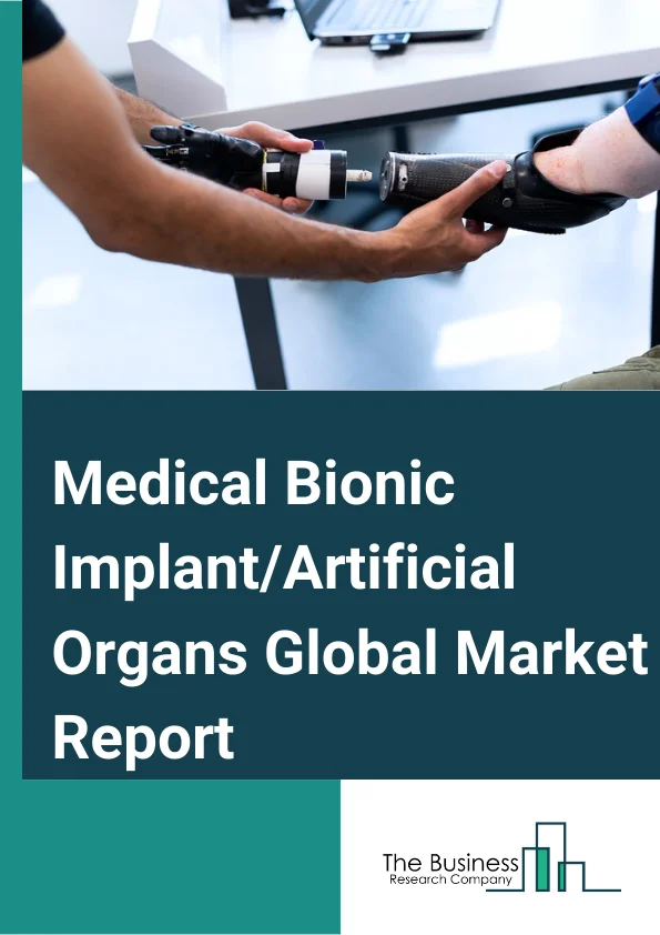 Medical Bionic Implant/Artificial Organs Market Report 2023 