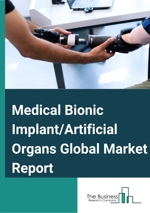 Medical Bionic Implant/Artificial Organs Global Market Report 2025 – By Type( Bionic Implants, Artificial Organs ), By Method Of Fixation( Implantable, Externally Worn ), By Technology( Electronic, Mechanical ), By Application( Hospitals, Clinics, Research and Academic Institutes, Other Applications ) – Market Size, Trends, And Global Forecast 2025-2034