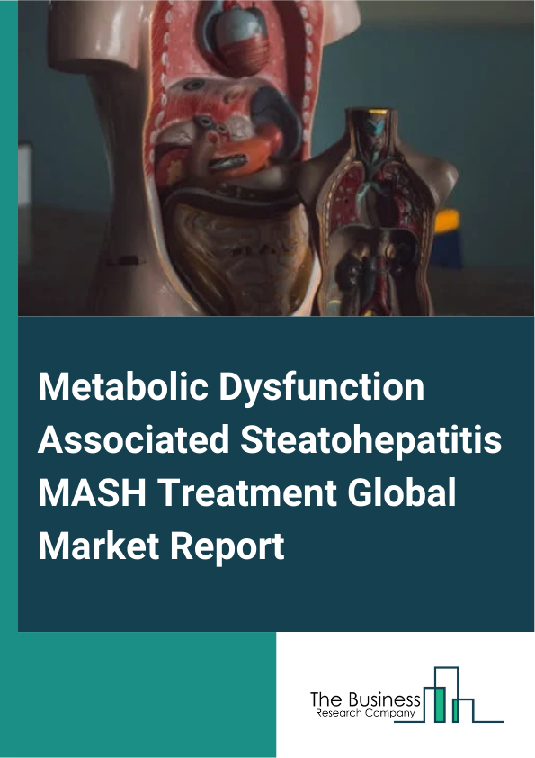 Metabolic Dysfunction Associated Steatohepatitis MASH Treatment